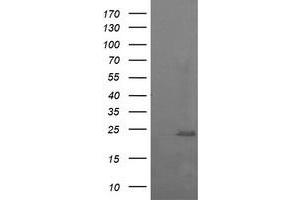 Image no. 2 for anti-RAB37, Member RAS Oncogene Family (RAB37) antibody (ABIN1500561)