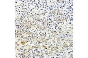 Immunohistochemistry of paraffin-embedded human tonsil using LDB1 antibody (ABIN7268255) at dilution of 1:200 (40x lens). (LIM Domain Binding 1 Protein antibody  (AA 1-50))