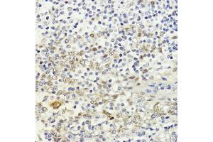 Immunohistochemistry of paraffin-embedded human tonsil using LDB1 antibody (ABIN7268255) at dilution of 1:200 (40x lens).