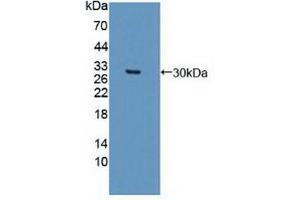 Western blot analysis of recombinant Human DCLK1. (DCLK1 antibody  (AA 390-647))