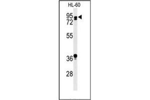Western blot analysis of PATL1 Antibody (C-term) in HL-60 cell line lysates (35ug/lane). (PATL1 antibody  (C-Term))