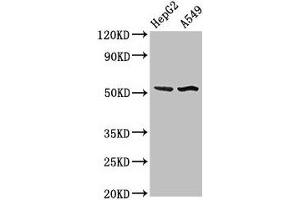 Western Blot Positive WB detected in: HepG2 whole cell lysate, A549 whole cell lysate All lanes: SPRED1 antibody at 3 μg/mL Secondary Goat polyclonal to rabbit IgG at 1/50000 dilution Predicted band size: 51 kDa Observed band size: 51 kDa (SPRED1 antibody  (AA 123-311))