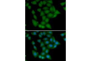 Immunofluorescence analysis of U2OS cells using CAMK1 antibody.