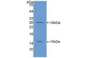 Detection of Recombinant Ki67P, Human using Polyclonal Antibody to Ki-67 Protein (Ki-67) (Ki-67 antibody  (AA 2815-2928))