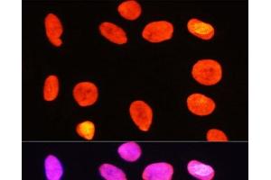 Immunofluorescence analysis of C6 cells using Symmetric DiMethyl-Histone H3-R2 Polyclonal Antibody at dilution of 1:100 (40x lens). (Histone 3 antibody  (H3R2me2s))