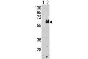 Image no. 1 for anti-Microtubule-Associated Protein tau (MAPT) (C-Term) antibody (ABIN357423) (MAPT antibody  (C-Term))