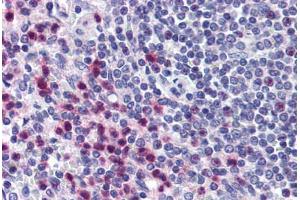 Human Spleen (formalin-fixed, paraffin-embedded) stained with STRAP antibody ABIN290242 at 10 ug/ml followed by biotinylated goat anti-rabbit IgG secondary antibody ABIN481713, alkaline phosphatase-streptavidin and chromogen. (STRAP antibody  (AA 230-280))