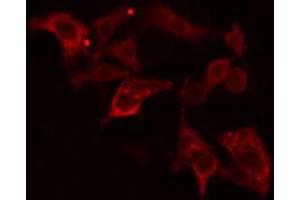 ABIN6274640 staining HepG2 cells by IF/ICC. (CYP26A1 antibody  (Internal Region))