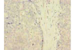 ZNF77 antibody  (AA 51-369)