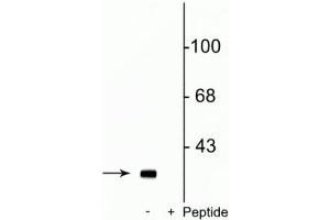 Western blot of rat striatal lysate showing specific immunolabeling of the ~32 kDa DARPP-32 phosphorylated at Ser137 in the first lane (-). (DARPP32 antibody  (pSer137))