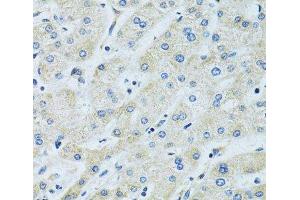 Immunohistochemistry of paraffin-embedded Human liver using SLC5A6 Polyclonal Antibody at dilution of 1:100 (40x lens). (SLC5A6 antibody)