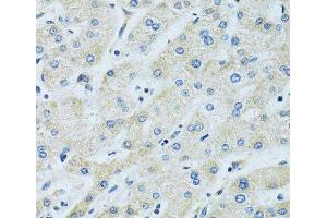Immunohistochemistry of paraffin-embedded Human liver using SLC5A6 Polyclonal Antibody at dilution of 1:100 (40x lens).