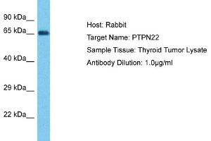 Host: Rabbit Target Name: PTPN22 Sample Type: Thyroid Tumor lysates Antibody Dilution: 1. (PTPN22 antibody  (Middle Region))