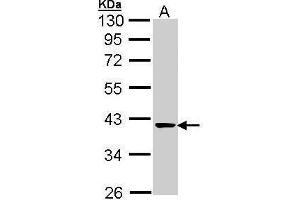 WB Image Sample (30 ug of whole cell lysate) A: A431 , 10% SDS PAGE antibody diluted at 1:1000 (TALDO1 antibody  (N-Term))