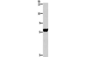 Gel: 6 % SDS-PAGE, Lysate: 40 μg, Lane: Mouse brain tissue, Primary antibody: ABIN7130690(PPP3CA Antibody) at dilution 1/650, Secondary antibody: Goat anti rabbit IgG at 1/8000 dilution, Exposure time: 1 second (PPP3CA antibody)
