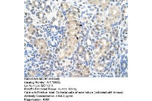Immunohistochemistry (IHC) image for anti-Minichromosome Maintenance Complex Component 7 (MCM7) (Middle Region) antibody (ABIN2774887)