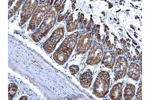 IHC-P Image ALDH2 antibody detects ALDH2 protein at mitochondria on mouse colon by immunohistochemical analysis. (ALDH2 antibody  (Center))