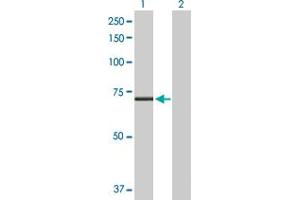 Western Blot analysis of CPT2 expression in transfected 293T cell line by CPT2 MaxPab polyclonal antibody.