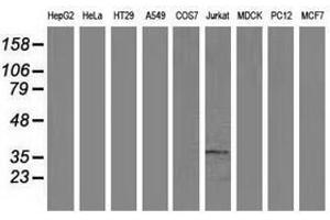 Image no. 3 for anti-Aminoacylase 3 (ACY3) antibody (ABIN1496463) (Aminoacylase 3 antibody)