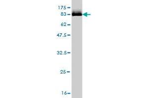 Western Blot detection against Immunogen (82. (STK33 antibody  (AA 1-514))