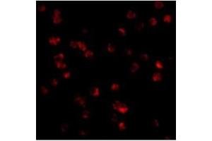 Immunofluorescence of TLR8 in Daudi cells with TLR8 antibody at 10 µg/ml. (TLR8 antibody  (Middle Region))