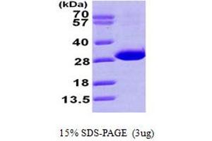 SDS-PAGE (SDS) image for Carbonyl Reductase 4 (CBR4) (AA 1-237) protein (His tag) (ABIN667836)