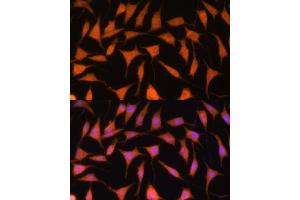 Immunofluorescence analysis of L929 cells using TIMM44 antibody (ABIN7270927) at dilution of 1:100. (TIMM44 antibody  (AA 153-452))