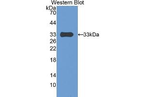 Western blot analysis of the recombinant protein. (PAPPA antibody  (AA 1270-1558))