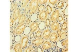 Immunohistochemistry of paraffin-embedded human kidney tissue using ABIN7154376 at dilution of 1:100 (GRHL2 antibody  (AA 1-265))