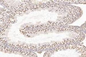 Immunohistochemistry analysis of paraffin-embedded rat testis using,WDR92 (ABIN7076222) at dilution of 1: 4200 (WDR92 antibody)