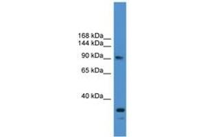 Image no. 1 for anti-Ubiquitin Specific Peptidase 13 (Isopeptidase T-3) (USP13) (AA 161-210) antibody (ABIN6745392)