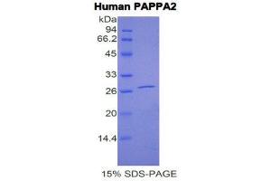 SDS-PAGE (SDS) image for Pappalysin 2 (PAPPA2) (AA 888-1093) protein (His tag) (ABIN1877772) (PAPPA2 Protein (AA 888-1093) (His tag))
