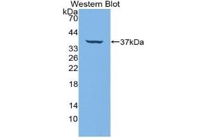 Western blot analysis of the recombinant protein. (IRF6 antibody  (AA 150-445))