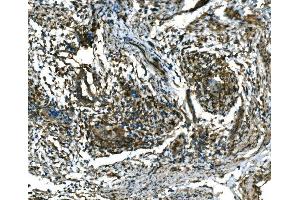 IHC analysis of RAB13 using anti-RAB13 antibody (ABIN7600599).