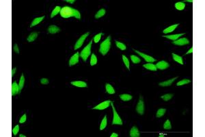 Immunofluorescence of purified MaxPab antibody to XIAP on HeLa cell. (XIAP antibody  (AA 1-497))