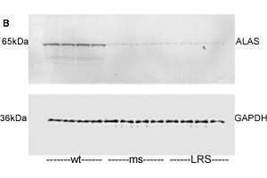 Mouse ferroportin, 5-aminolevulinic acid synthase (ALAS), and ferritin light chain (FLC) proteins are increased in sickle mice overexpressing human wt-FHC. (ALAS2 antibody  (Center))