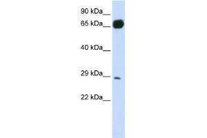 WB Suggested Anti-PRTFDC1 Antibody Titration:  0.
