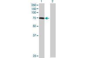 Western Blot analysis of PKP1 expression in transfected 293T cell line by PKP1 MaxPab polyclonal antibody. (Plakophilin 1 antibody  (AA 1-726))