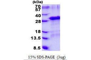 Figure annotation denotes ug of protein loaded and % gel used. (GFER Protein)