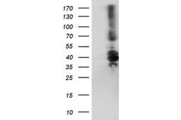 Dystrobrevin beta antibody