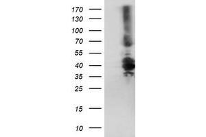 Western Blotting (WB) image for anti-Dystrobrevin, beta (DTNB) antibody (ABIN1497915) (Dystrobrevin beta antibody)