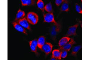 Immunocytochemistry staining of vesicles (red) in RBL-2H3 rat basophilic leukemia cell line using anti-Kinesin (KN-02).