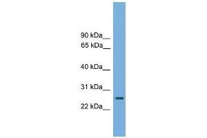 RAB35 antibody used at 0. (RAB35 antibody  (Middle Region))