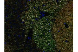 Indirect immunostaining of PFA fixed paraffin embedded mouse hippocampus section with anti-Piccolo (dilution 1 : 500; green) and rabbit anti-Homer 1 (, dilution 1 : 500; red). (Piccolo antibody  (Center))