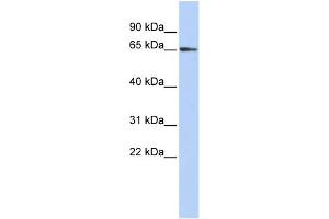 WB Suggested Anti-ZFP3 Antibody Titration:  0.