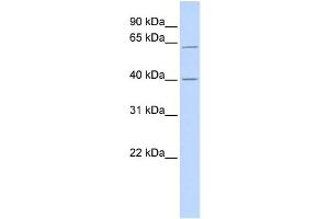WB Suggested Anti-TRIT1 Antibody Titration:  0. (TRIT1 antibody  (Middle Region))