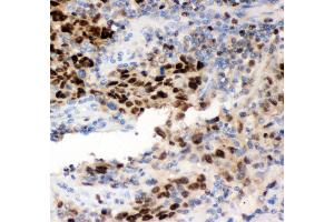 Immunohistochemistry (IHC) image for anti-Minichromosome Maintenance Complex Component 7 (MCM7) (AA 526-719) antibody (ABIN3043877)