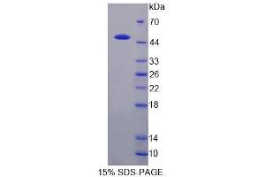 SDS-PAGE analysis of Cow CSN3 Protein. (CSN3 Protein)