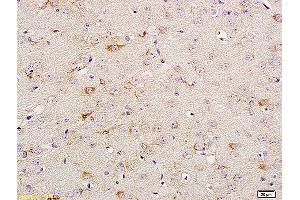 Formalin-fixed and paraffin embedded rat brain tissue labeled with Anti Phospho-TrkA (Tyr674/675) /TrkB (Tyr706/707) Polyclonal Antibody, Unconjugated (ABIN746618) at 1:200 followed by conjugation to the secondary antibody and DAB staining.