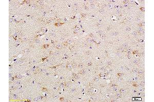 Formalin-fixed and paraffin embedded rat brain tissue labeled with Anti Phospho-TrkA (Tyr674/675) /TrkB (Tyr706/707) Polyclonal Antibody, Unconjugated (ABIN746618) at 1:200 followed by conjugation to the secondary antibody and DAB staining. (TRKA antibody  (pTyr680, pTyr681))